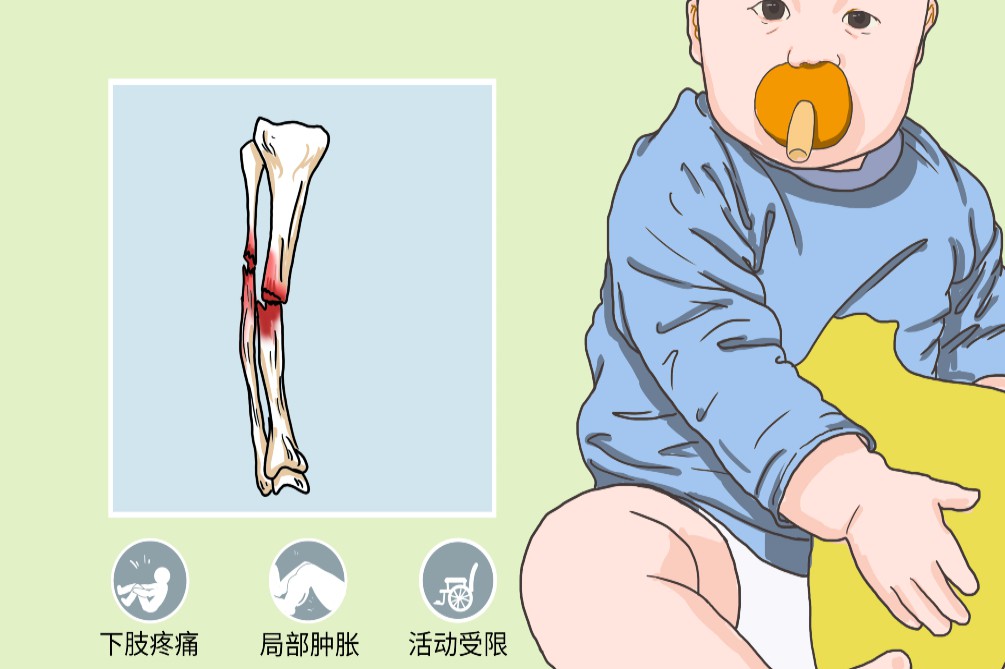 ＂妇幼保健学＂如何判断脚是否骨折,如何判断脚是否骨折或骨裂
